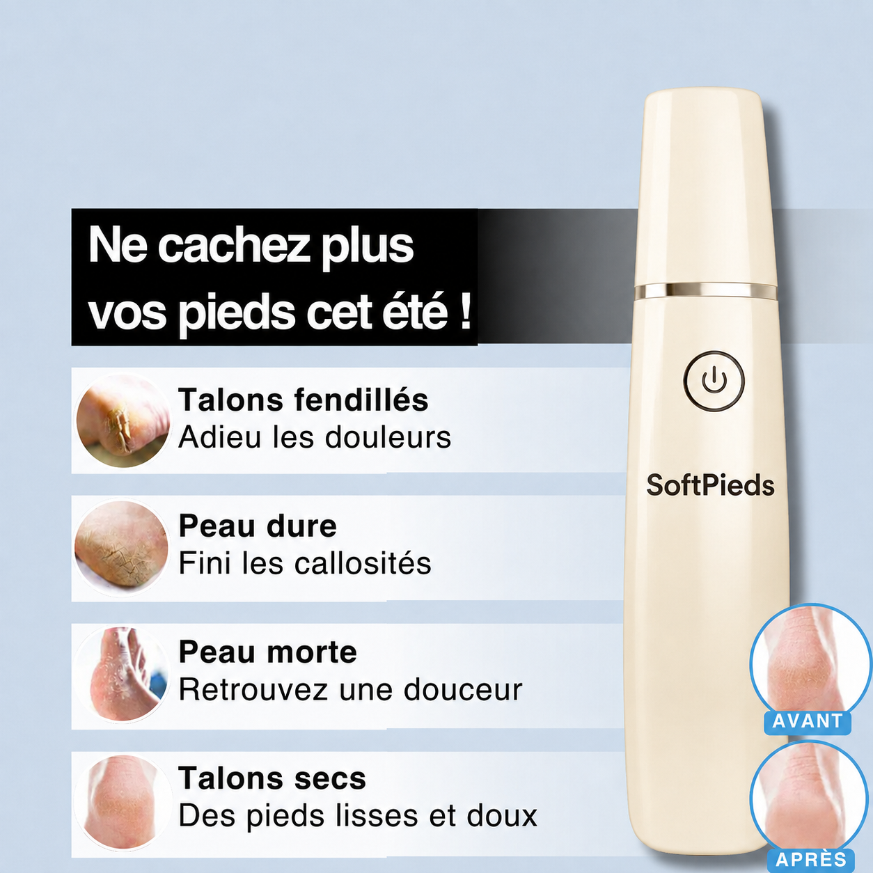 SoftPieds™- Appareil de Pédicure Anti-Callosités